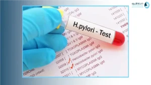 أسعار وأساليب تحليل جرثومة المعدة: كيف تختار الفحص المناسب وتحضر له؟